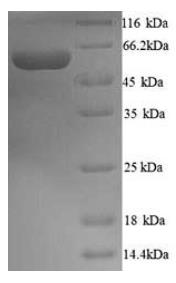 SDS-PAGE (YAP1-1556H).jpg